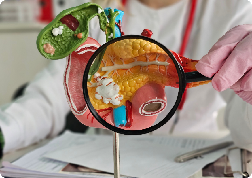 Introduction to GI & HPB Surgery for SS